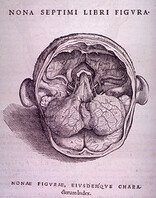 Brain Plate