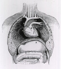 Distended stomach and colon