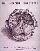 Brain Plate