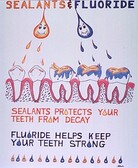 Sealants & fluoride