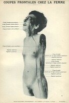 Coupes frontales chez la femme