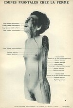 Coupes frontales chez la femme