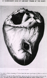 Cardiovascular system
