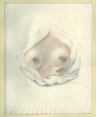 Three-breasted woman