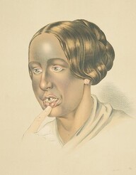 Woman with bronze tan