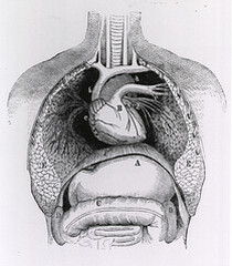 Distended stomach and colon