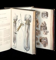 Glass tubes and accompanying pumps. Eye surgery