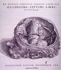 Brain Plate