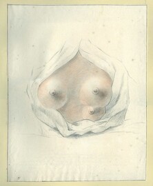 Three-breasted woman