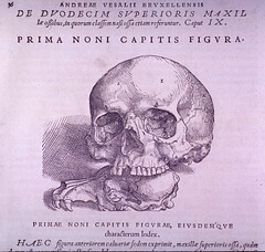 Bone Plate