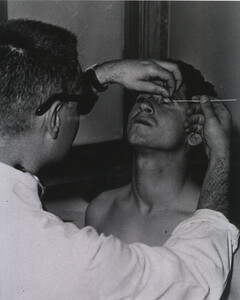 Dr. Franco Ermenegildo at the Naples Foreign Quarantine Station examines the eyes of 23-year-old Francesco Rotundo from Catanzaro, Italy, for trachoma