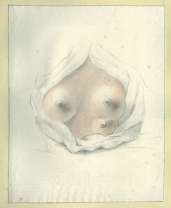 Three-breasted woman