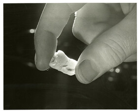 Teeth such as these are examined under an electron microscope after special treatment