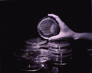 Cold virus research. Petri dishes